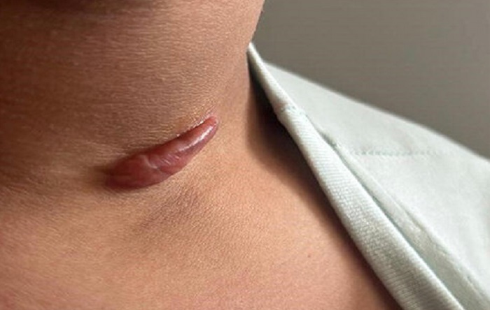 AVS PLASTIC SURGERY AND SKIN CLINIC Pudukkottai